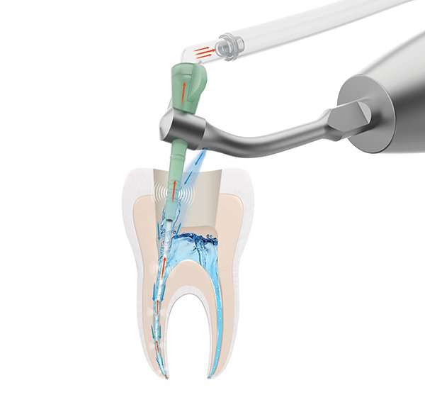 iVAC SISTEMA DI IRRIGAZIONE INTRO KIT