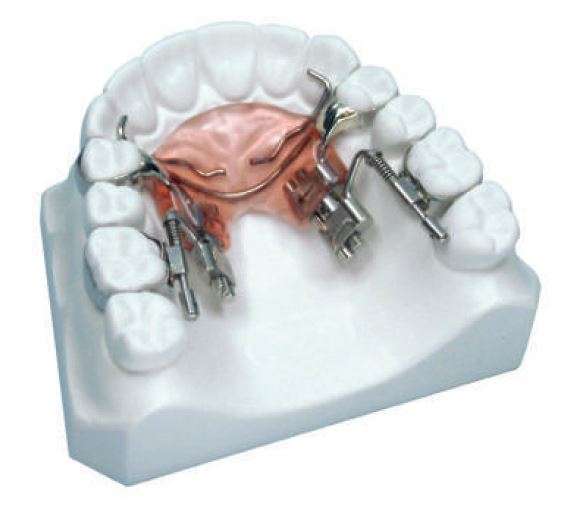DISTALIZZATORE FAST BACK 1 CASO LEONE
